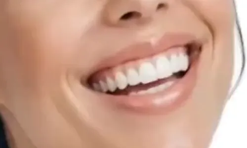 Sorriso do paciente após o tratamento